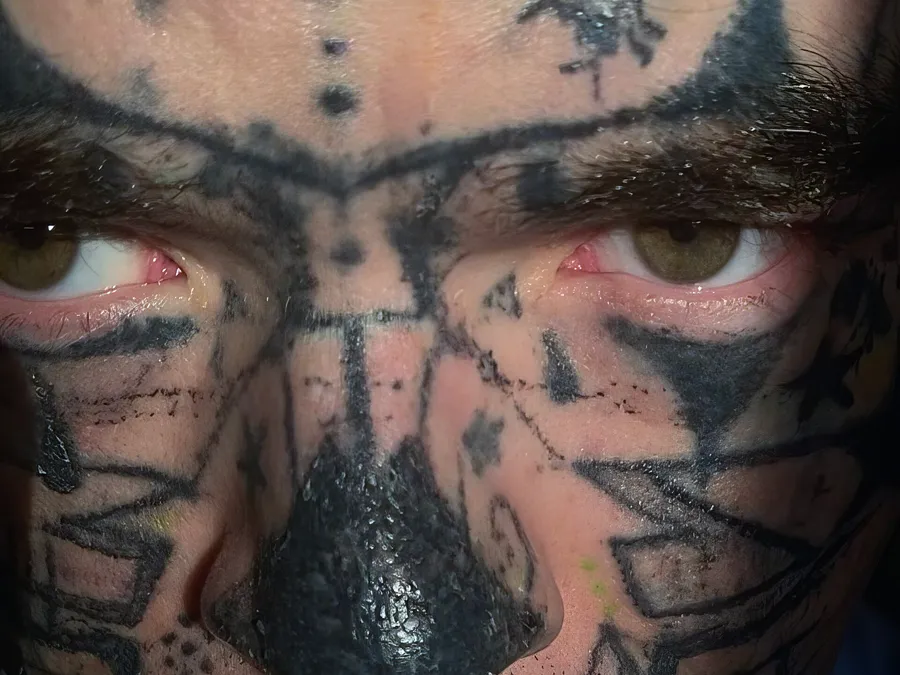 tattoo removal course