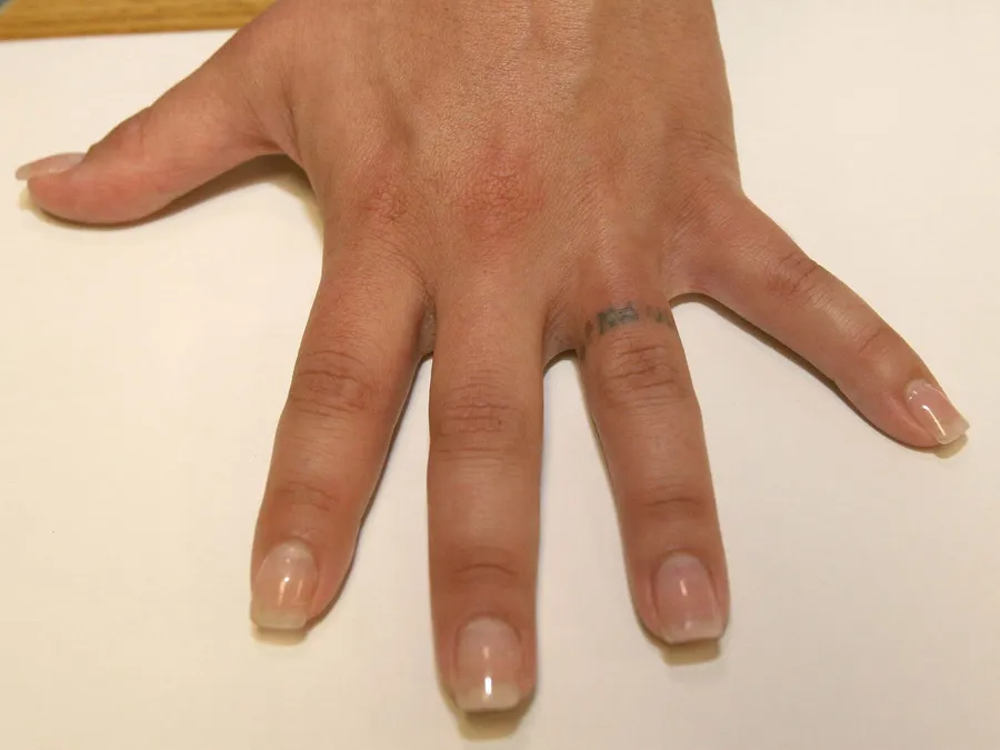 Choosing in tattoo removal course